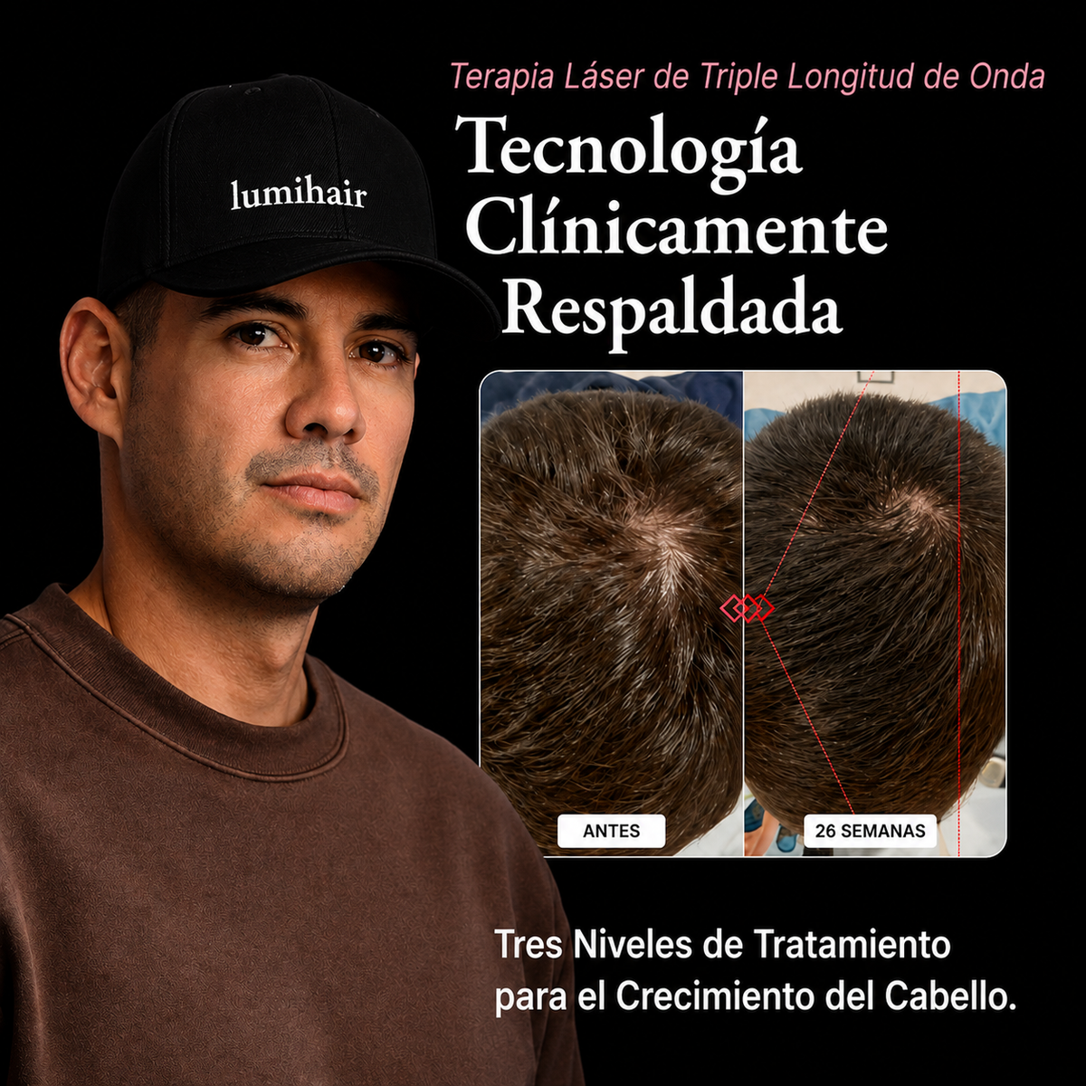 LumiHair Pro